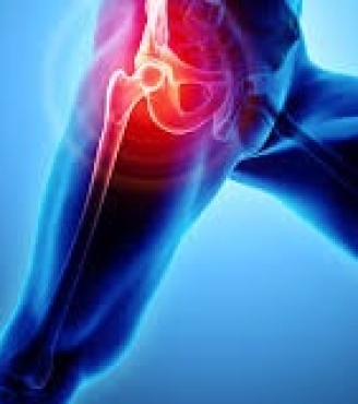 Παραισθητική μηραλγία